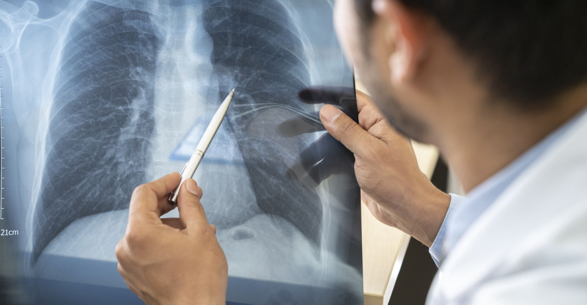 The Crucial Role of Pulmonologists in Respiratory Health